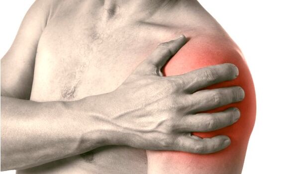 Swollen, red and enlarged shoulders - symptoms of grade 2-3 shoulder joint arthrosis
