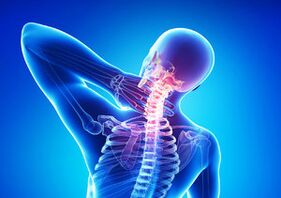 Sign of cervical osteochondrosis