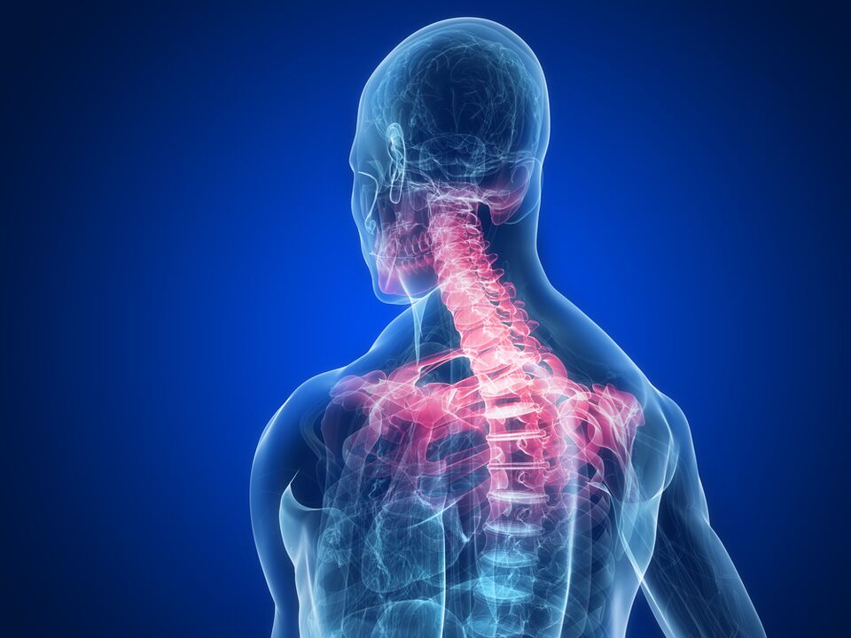 spondyloarthrosis as a cause of pain between the shoulder blades