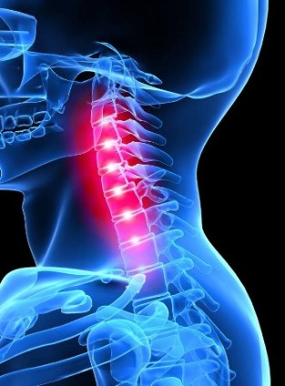 Osteocondrose neck